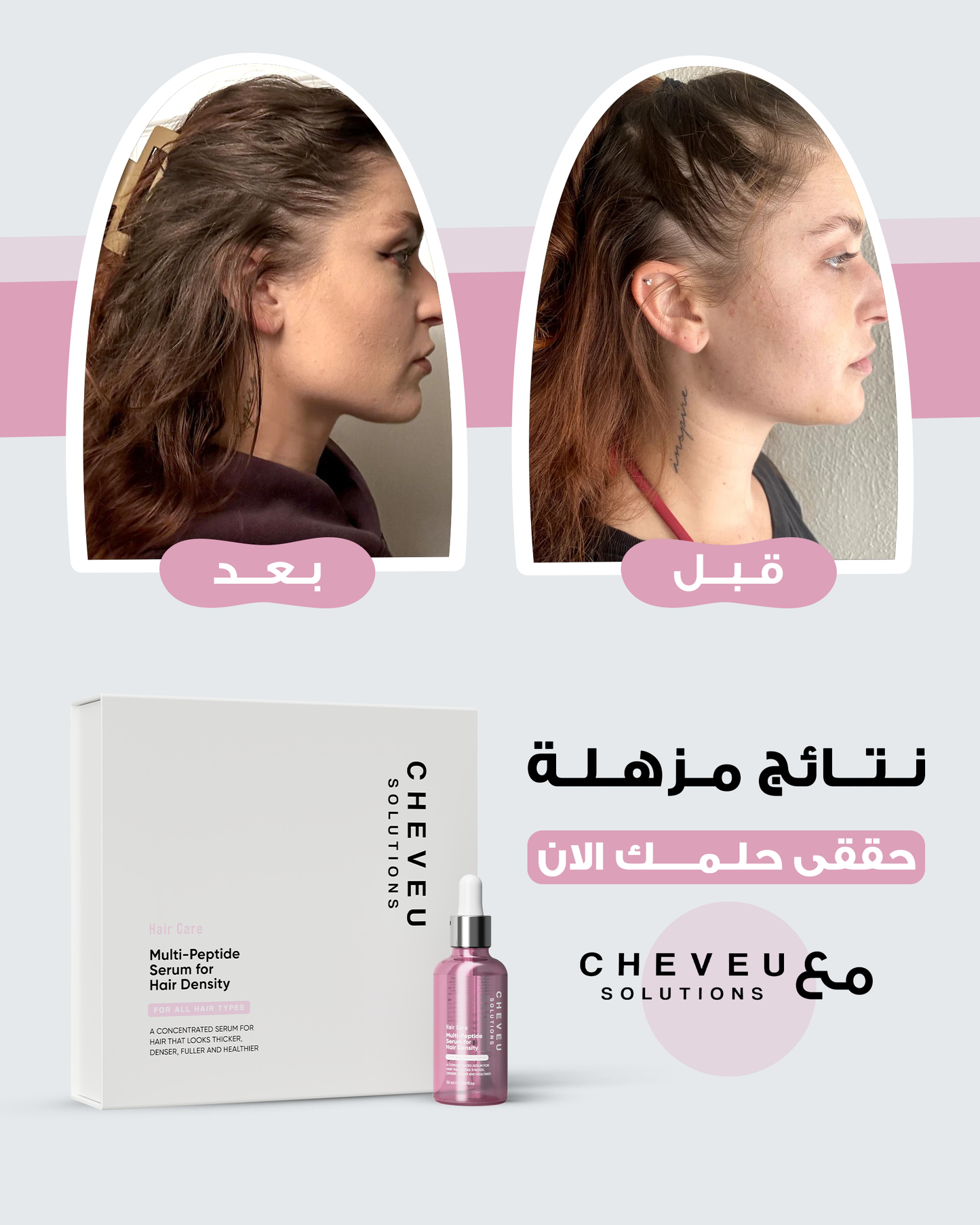 Cheveu Complex™ Hair Growth Kit for Women | 90-Day Supply with 5% AQUAXYL™